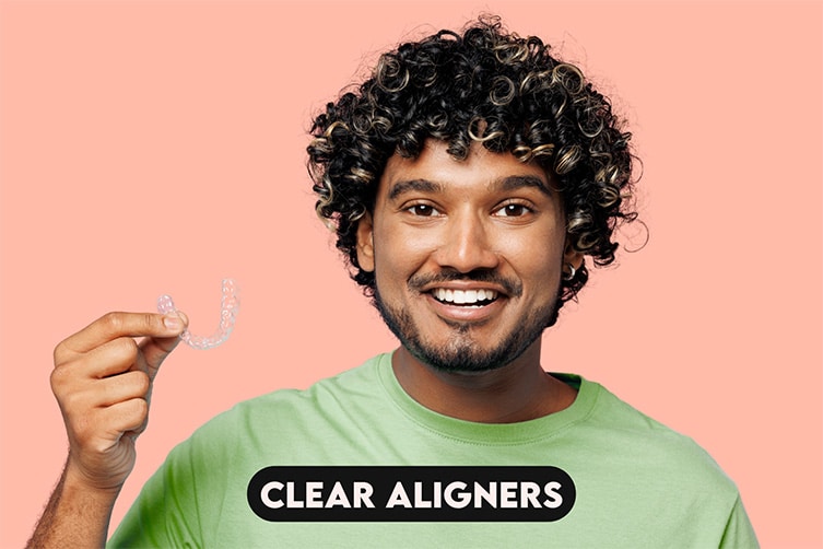 Clear Aligners