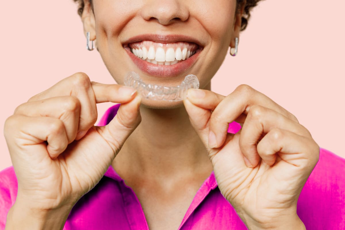 clear aligner