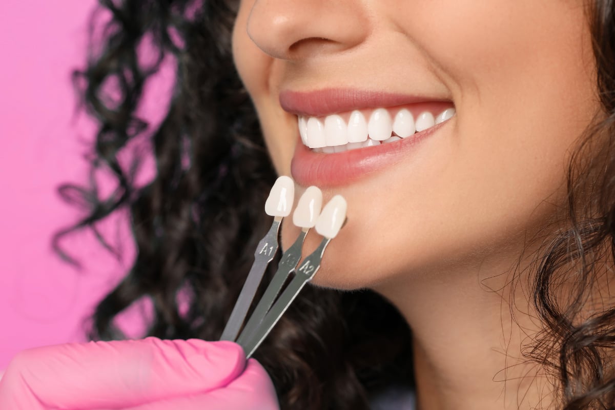 Before and After Image of Whitened Teeth