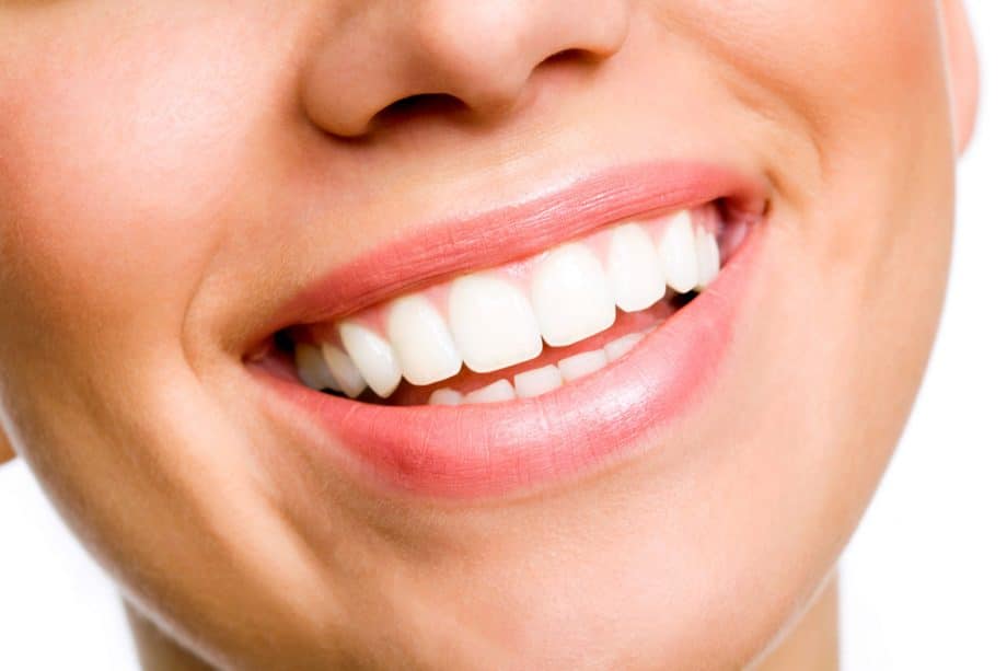 How Long Does Teeth Whitening Last?